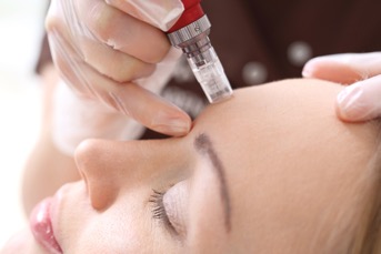 Today, microneedling is thriving as one of our most popular skin perfectors.
