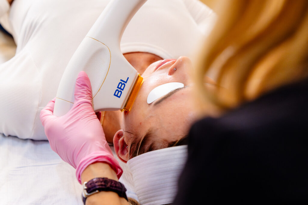 Wearing protective gloves, a provider gently places the BBL device on her patient’s cheek. This advanced light therapy in Leesburg, VA, helps patients age gracefully and achieve clear, radiant skin.
