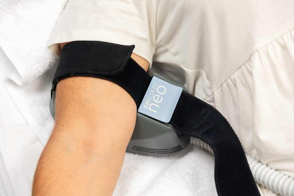 A patient is lying on her back with an arm outstreched and an applicator for the Emsculpt NEO in Loudoun County strapped around her upper arm. This is part of a series of treatments to tone and contour her arms.