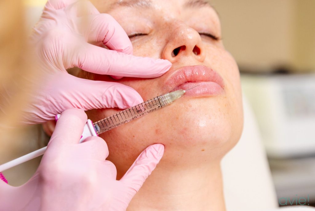 dermal fillers northern virginia